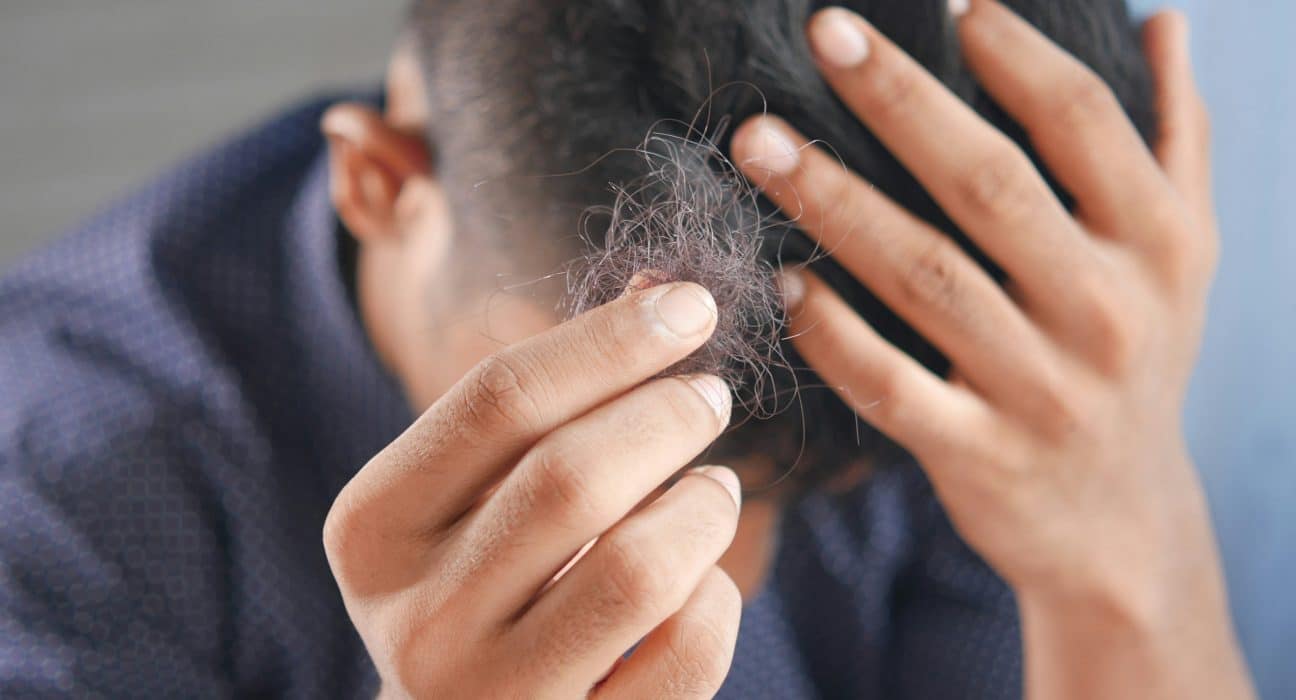 Dr. Bruce Marko Hair Loss