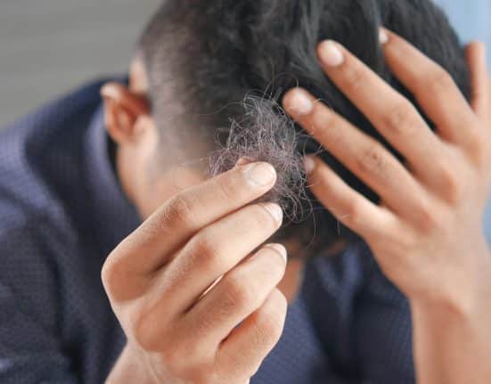 Dr. Bruce Marko Hair Loss
